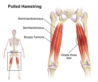 Hamstrings