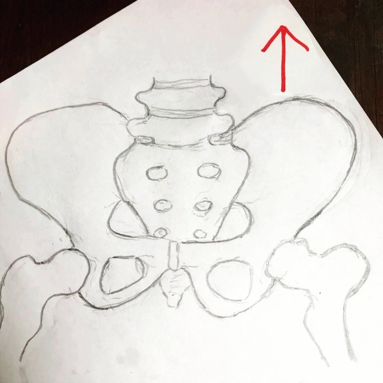What is an upslip? My Sacroiliac Joint Saga